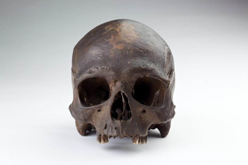 An image of a human skull